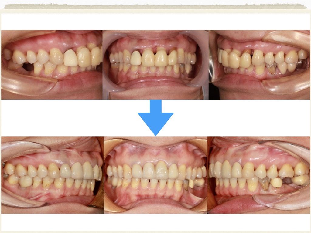 矯正案例－鍾思遠醫師