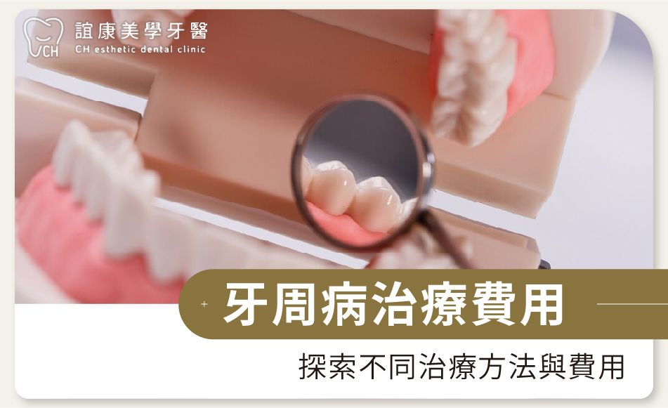 牙周病治療費用：探索不同治療方法與費用
