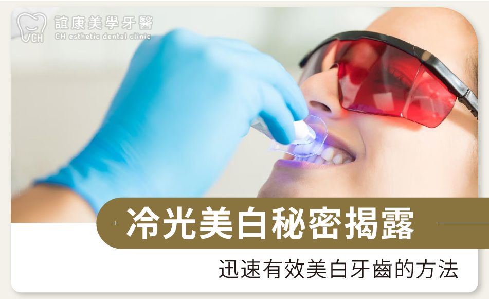 冷光美白秘密揭露：迅速有效美白牙齒的方法